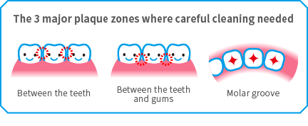 The 3 major plaque zones where dirt builds up easily. Between the teeth. Between the teeth and gums. In the depression of the molars.
